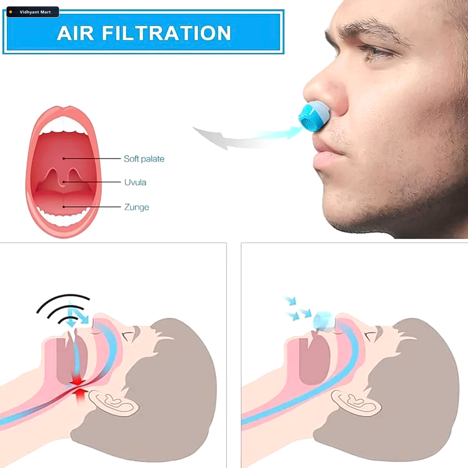 Vidhyant Mart Anti Snoring Nose Clip 2 In 1 Air Purifier Device 2
