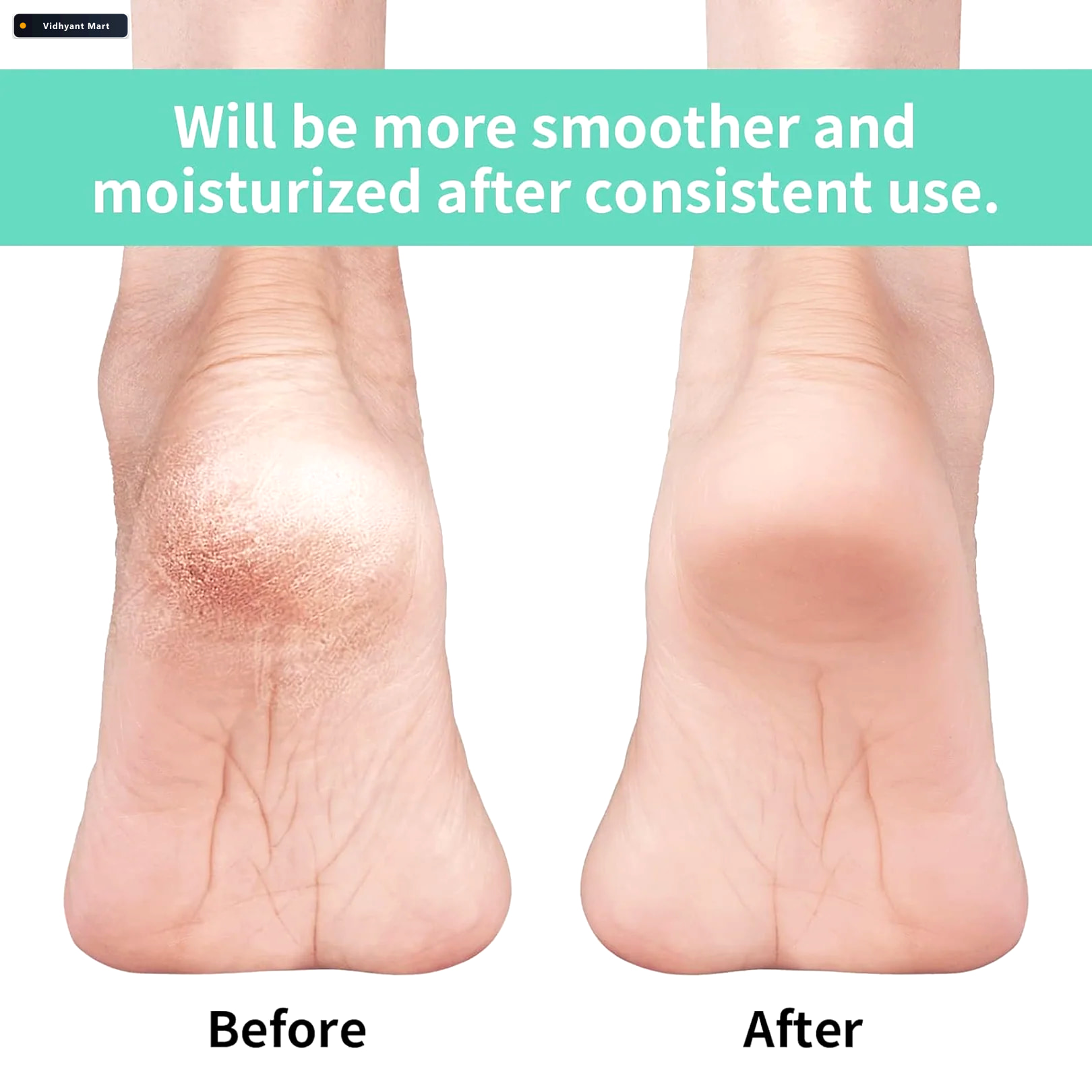 Vidhyant Mart Silicone Gel Heel Socks Cracked Heels Remedy Velve 3