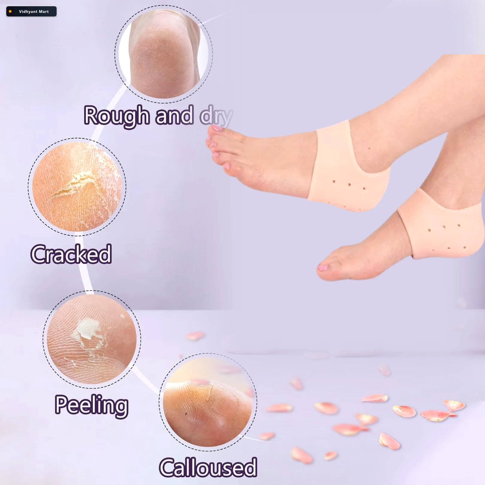 Vidhyant Mart Silicone Heel Protectors Anti Crack Moisturizing S 2