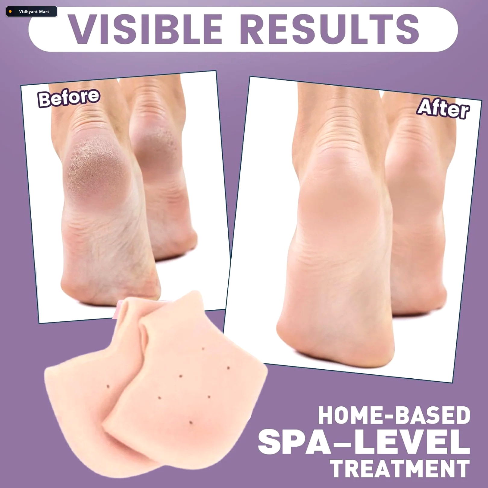 Vidhyant Mart Silicone Heel Protectors Anti Crack Moisturizing S 3
