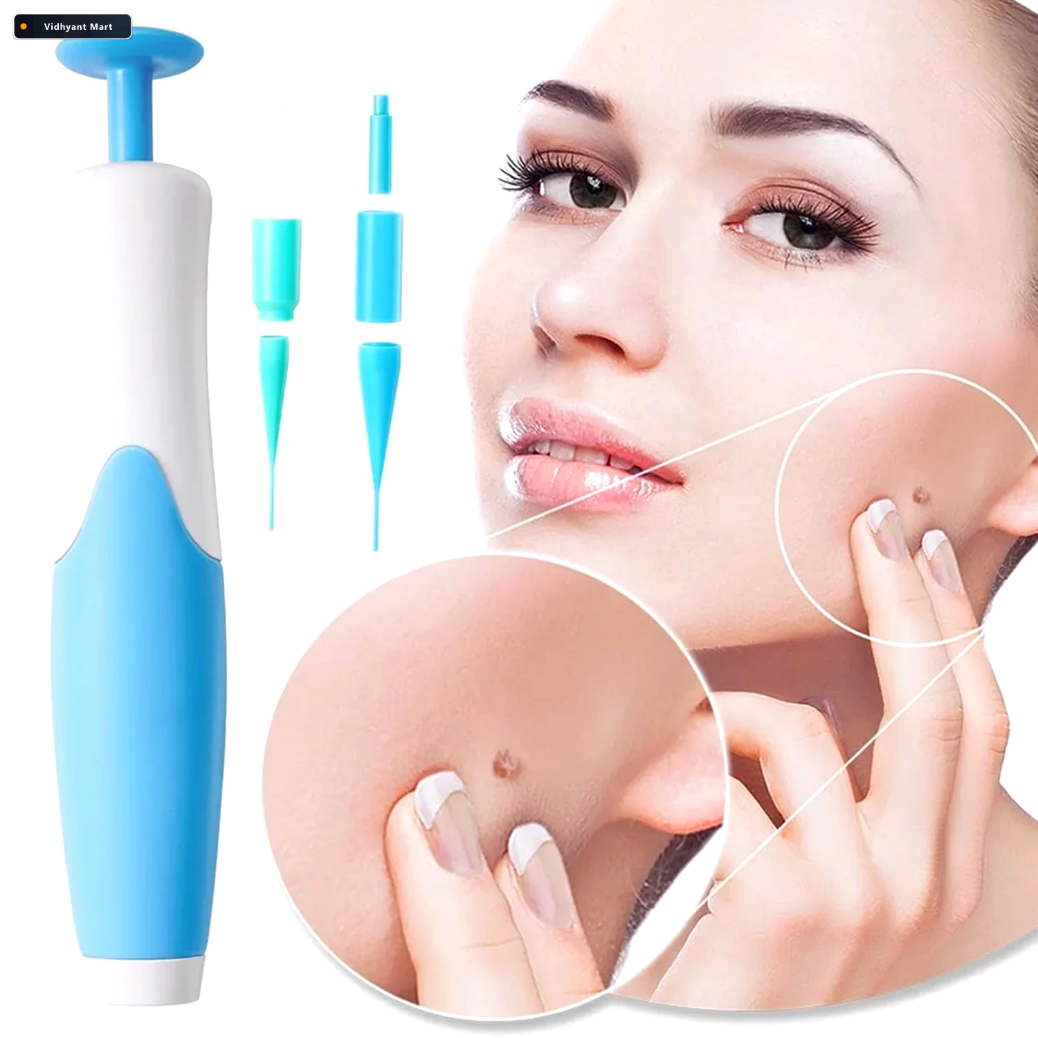 Vidhyant Mart Skin Tag Remover Kit For Face Care With Applicator 2