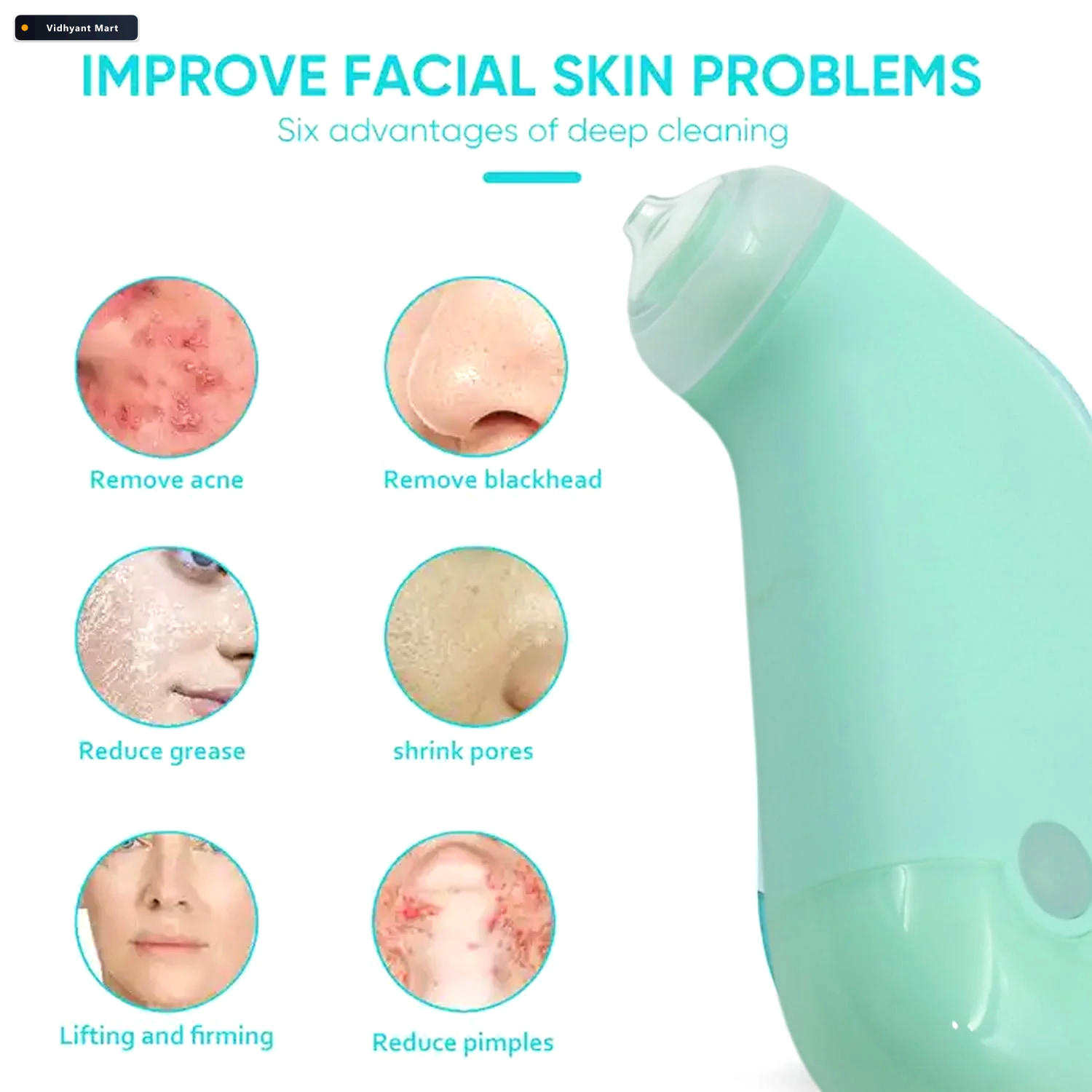 Vidhyant Mart Vacuum Blackhead Remover Mini Handheld Facial Tool 3